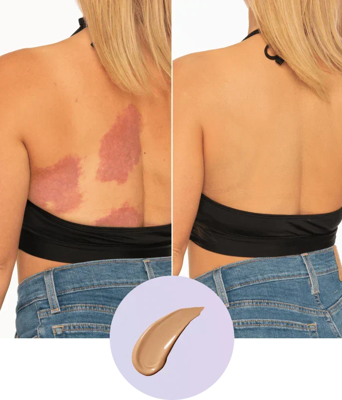 💜✨Body Coverage Perfector – Waterproof, Lightweight & Flawless Body Makeup