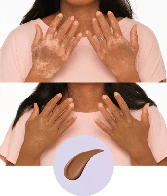 💜✨Body Coverage Perfector – Waterproof, Lightweight & Flawless Body Makeup