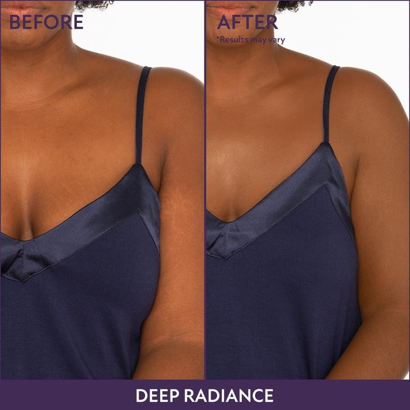 💜✨Body Coverage Perfector – Waterproof, Lightweight & Flawless Body Makeup